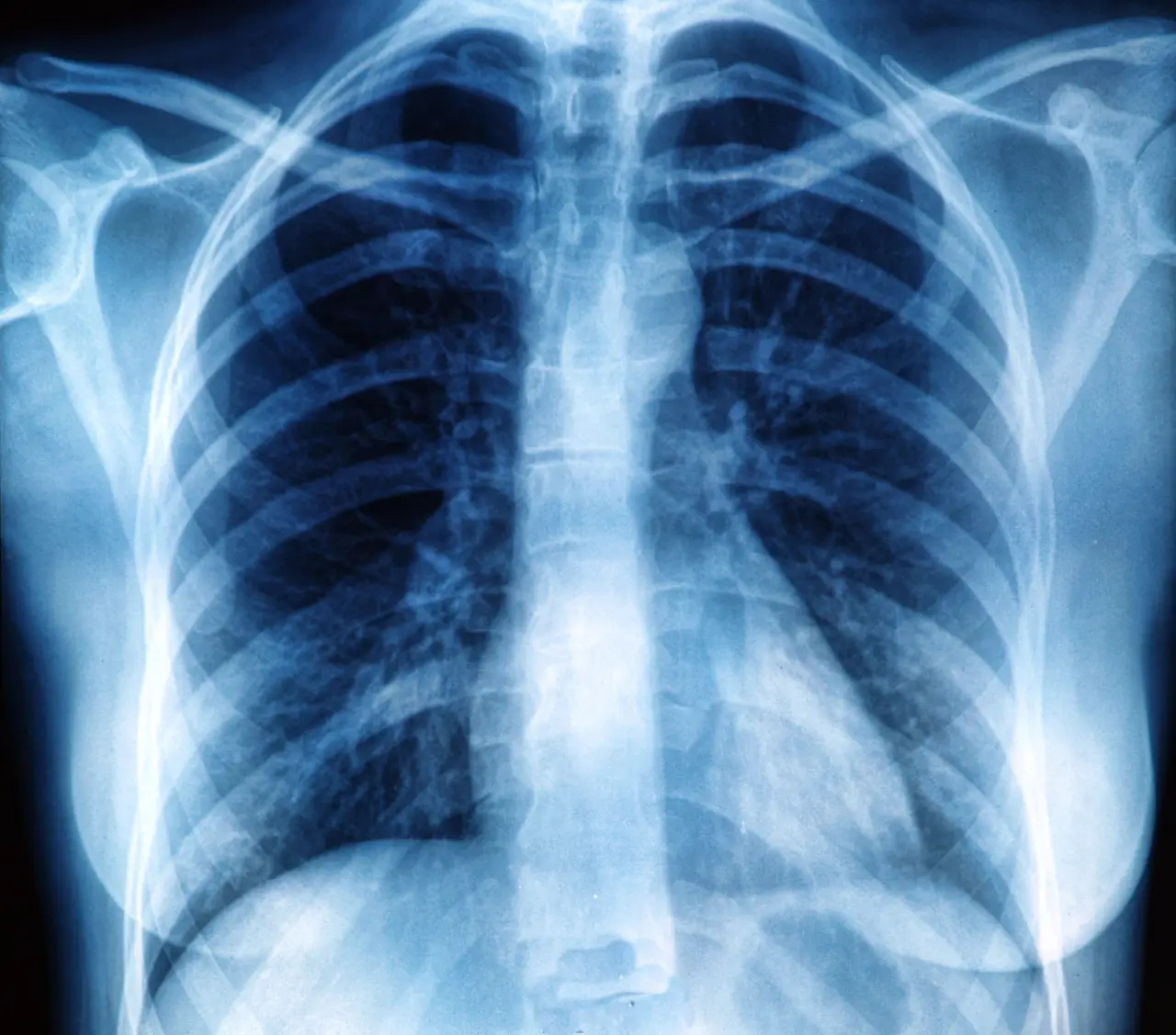 Medical / X-Ray